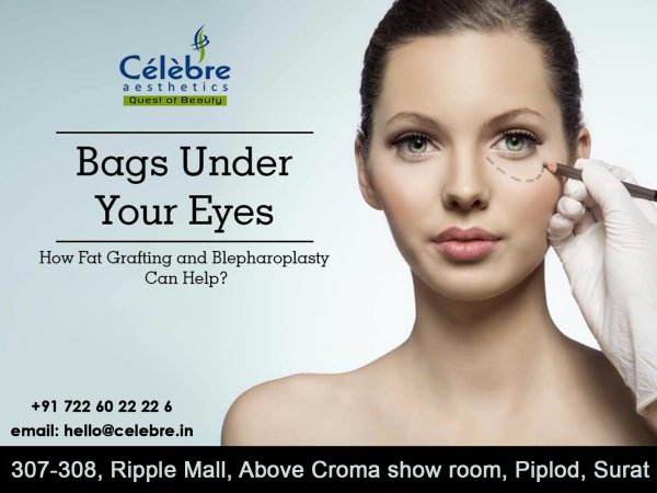 bags-under-your-eyes