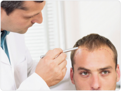 PRP Therapy in Surat