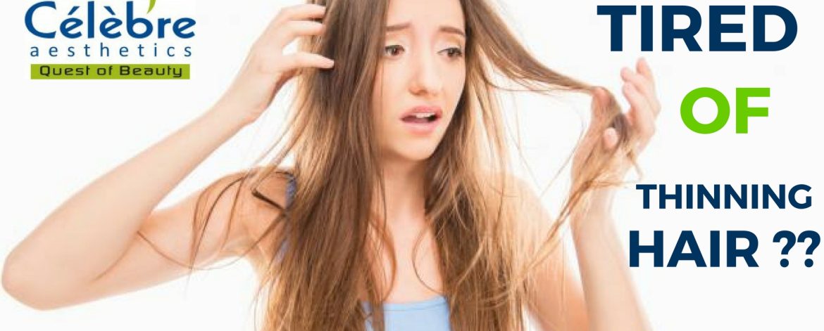 Tired-of-thinning-Hair Tired-of-thinning-Hair