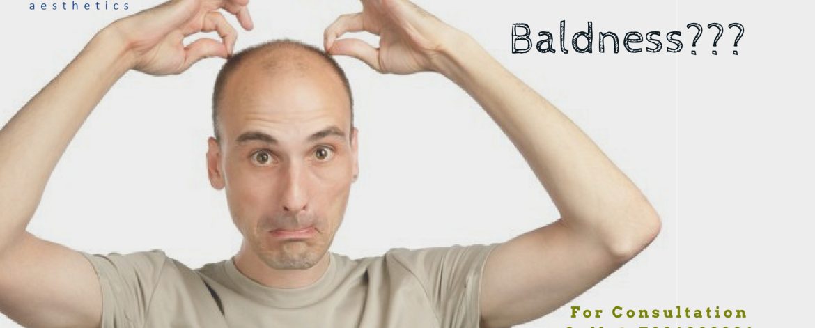 Tired-with-your-baldness Tired-with-your-baldness