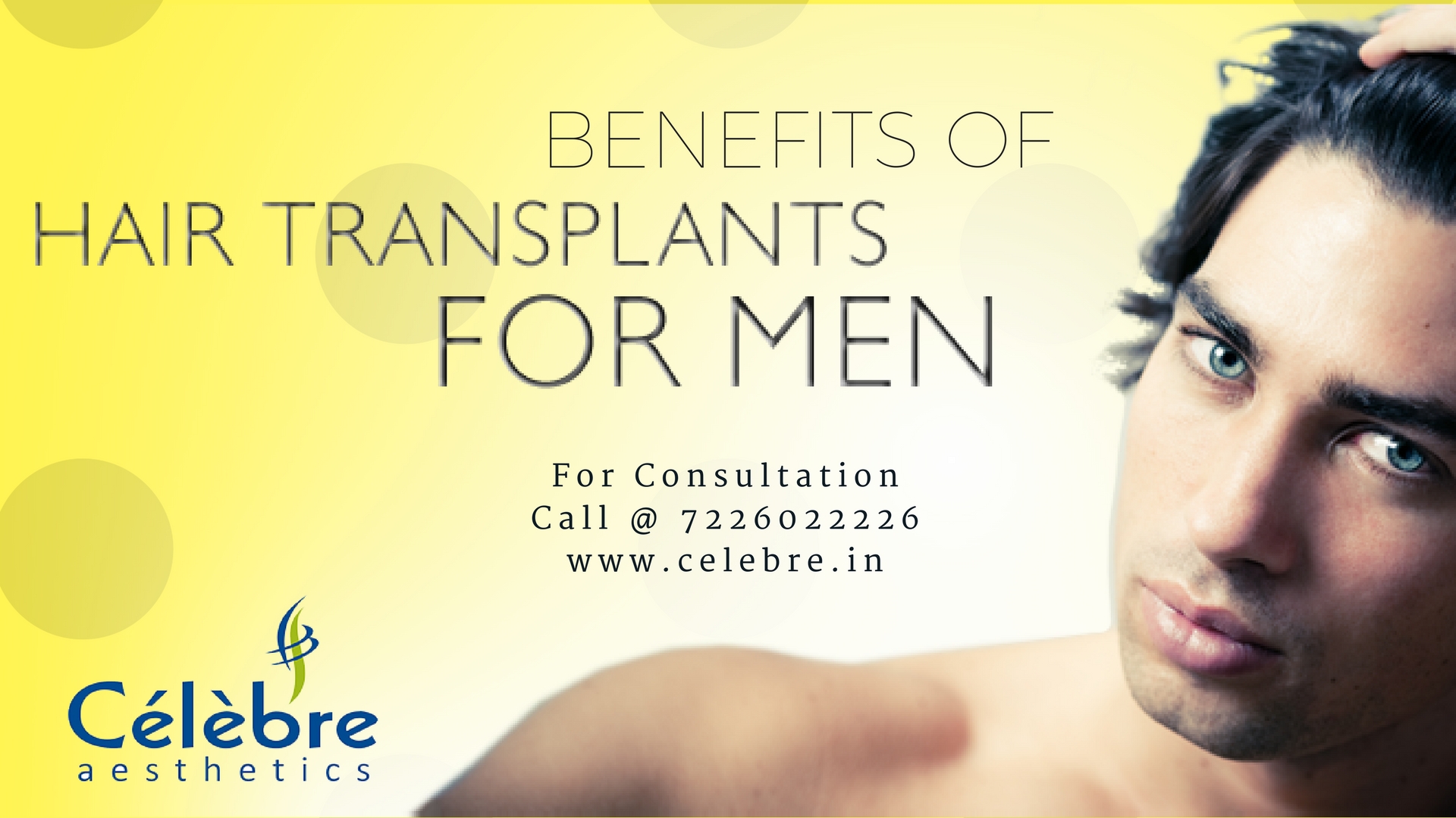 Benefits of Hair Transplant