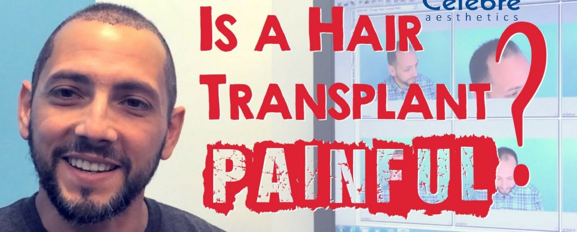 Is-a-hair-transplant-painful- Is-a-hair-transplant-painful-