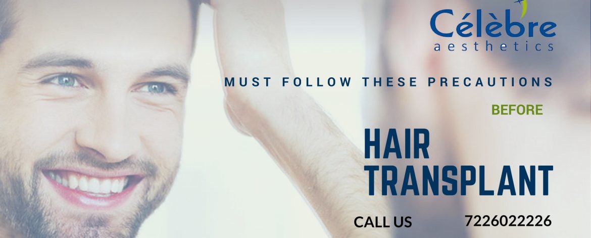 Precautions-to-follow-before-hair-transplant-surgery Precautions-to-follow-before-hair-transplant-surgery