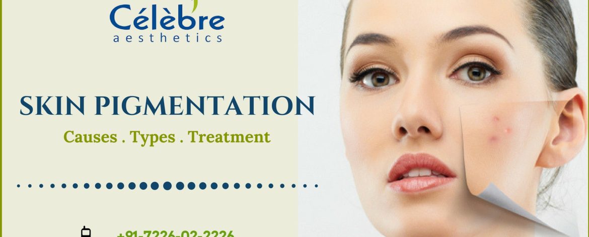 Skin-Pigmentation-Causes-Types-and-Treatment-in-Surat Skin-Pigmentation-Causes-Types-and-Treatment-in-Surat