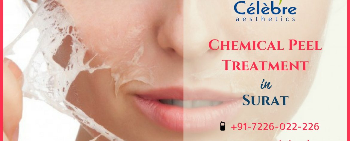 Chemical-Peel-Treatment-in-Surat-1 Chemical-Peel-Treatment-in-Surat-1