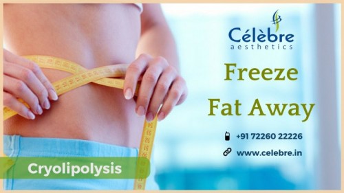 Cyrolipolysis Treatment in Surat