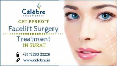 Facelift Surgery