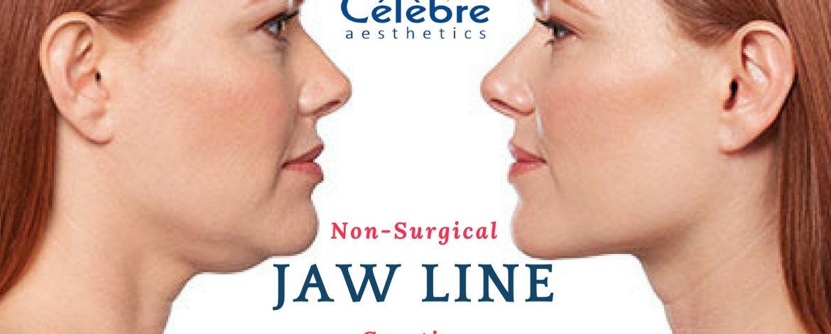 Non-Surgical-Jaw-Line-Creation Non-Surgical-Jaw-Line-Creation