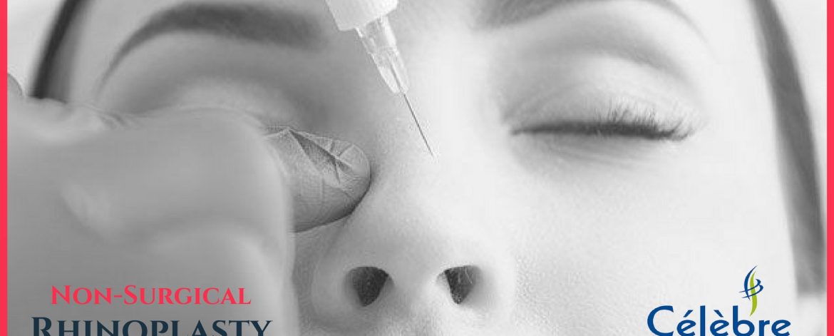 Non-Surgical-Rhinoplasty-in-Surat Non-Surgical-Rhinoplasty-in-Surat