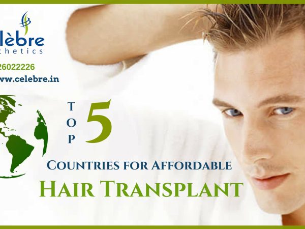 Top-5-Countries-for-Affordable-Hair-Transplant