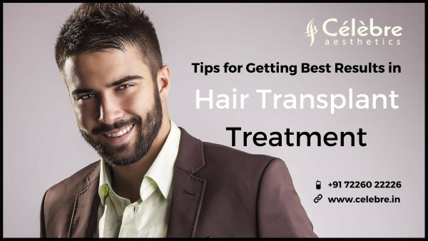 Hair Transplant Treatment in Surat