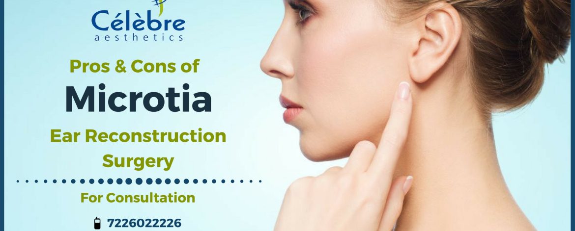 Microtia-Ear-Reconstruction-Surgery-in-Surat Microtia-Ear-Reconstruction-Surgery-in-Surat