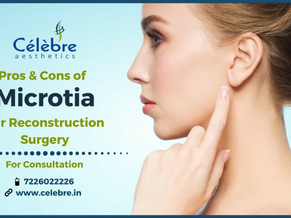 Microtia-Ear-Reconstruction-Surgery-in-Surat