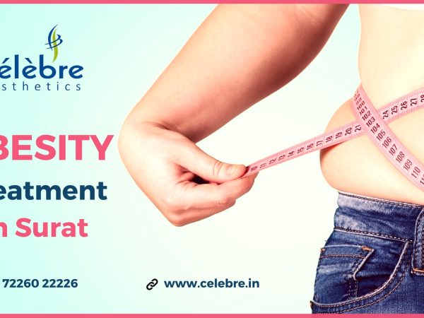 Obesity-Treatment-in-Surat