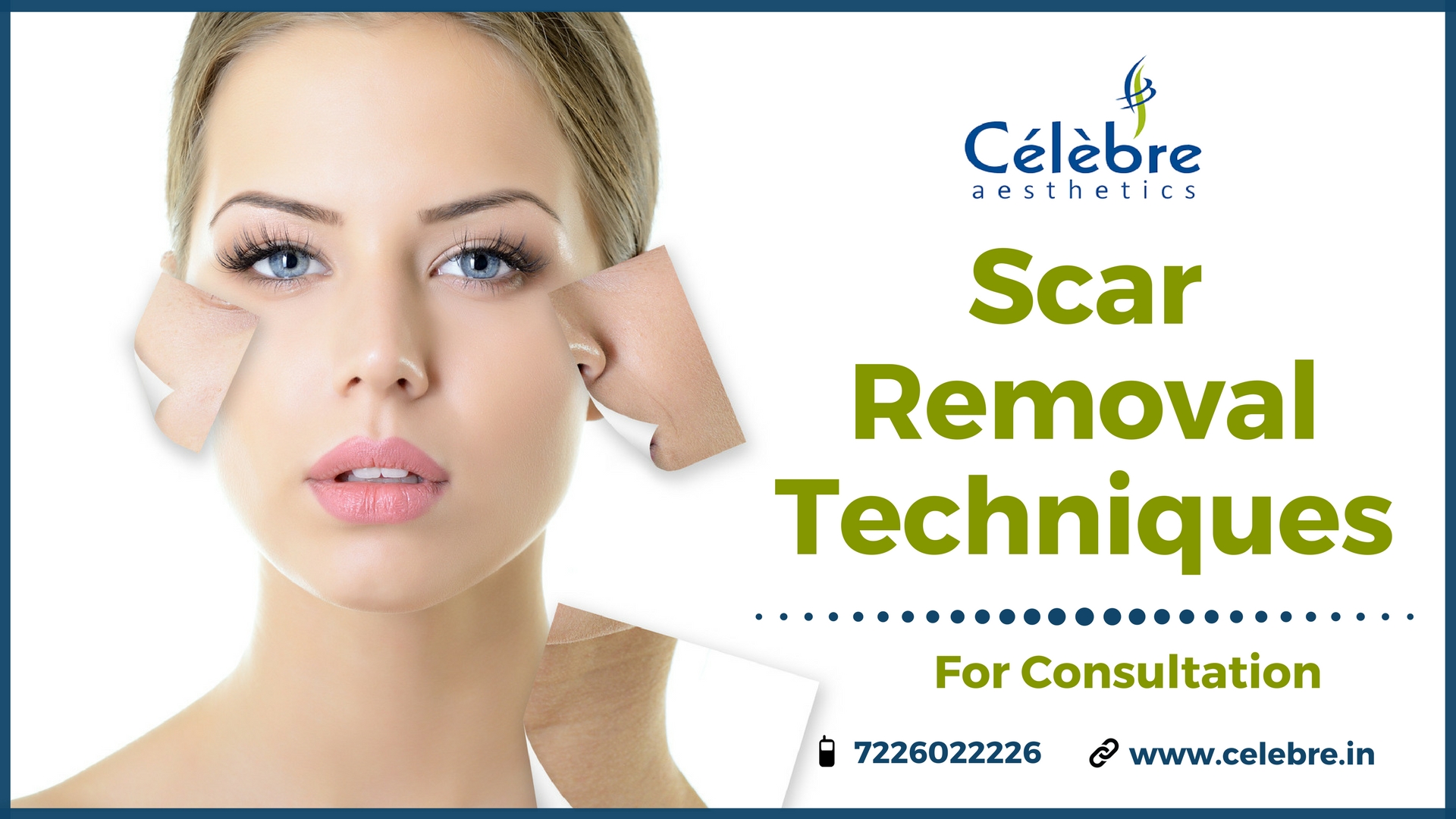 Scar Removal Techniques