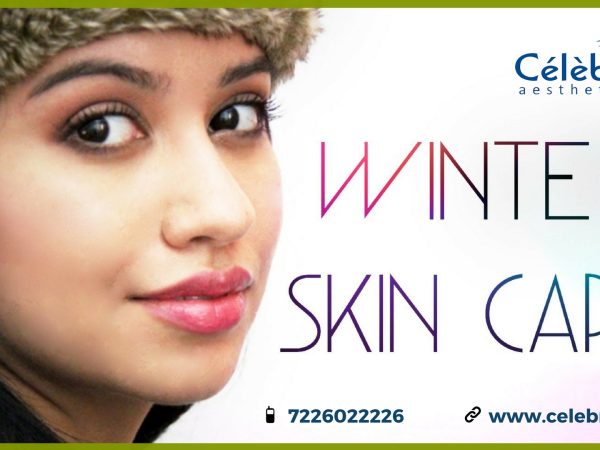 Winter-Season-Skin-Care-Tips