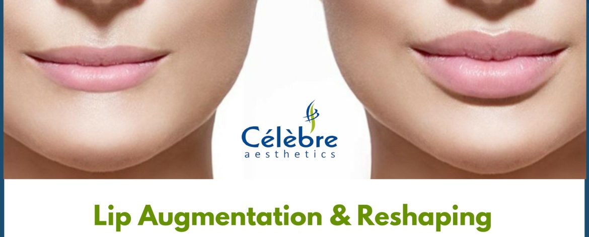 Lip-Augmentation-Reshaping Lip-Augmentation-Reshaping