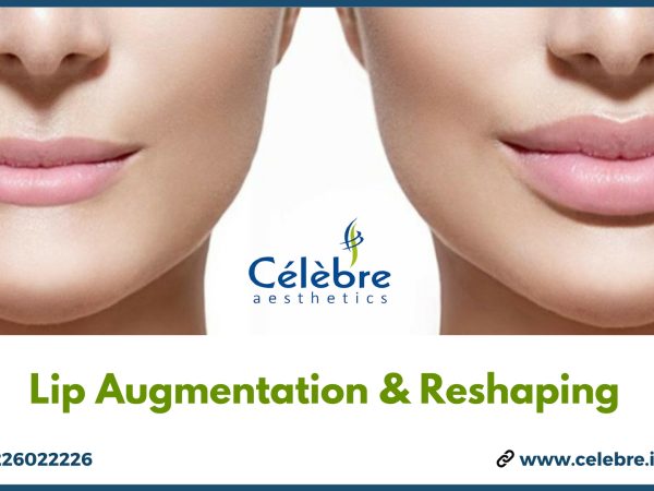 Lip-Augmentation-Reshaping