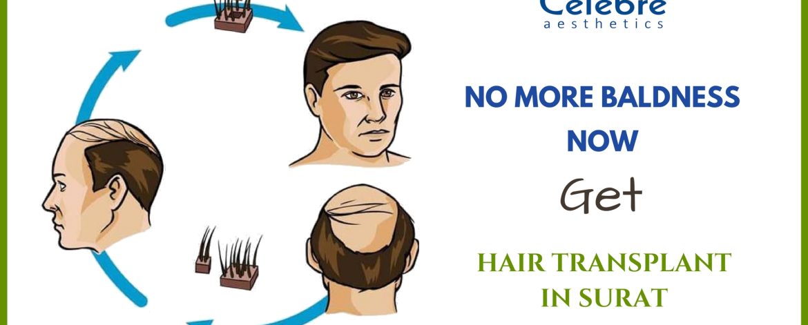 Hair-Transplant-in-Surat-1 Hair-Transplant-in-Surat-1