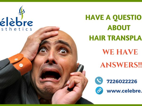 FAQ-Hair-Transplant-in-Surat
