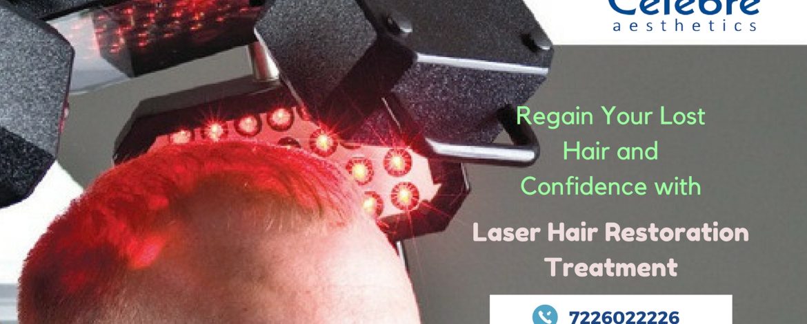 Laser-Hair-Restoration-Treatment-in-Surat Laser-Hair-Restoration-Treatment-in-Surat