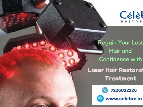 Laser-Hair-Restoration-Treatment-in-Surat