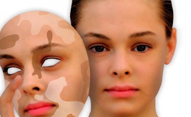Best Skin Specialist in Surat