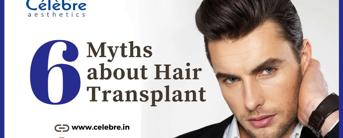 6_Myths_About_Hair_Transplant 6_Myths_About_Hair_Transplant