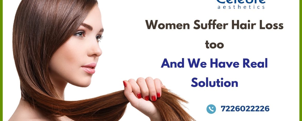 Best-Hair-Transplant-in-Surat-for-Women Best-Hair-Transplant-in-Surat-for-Women