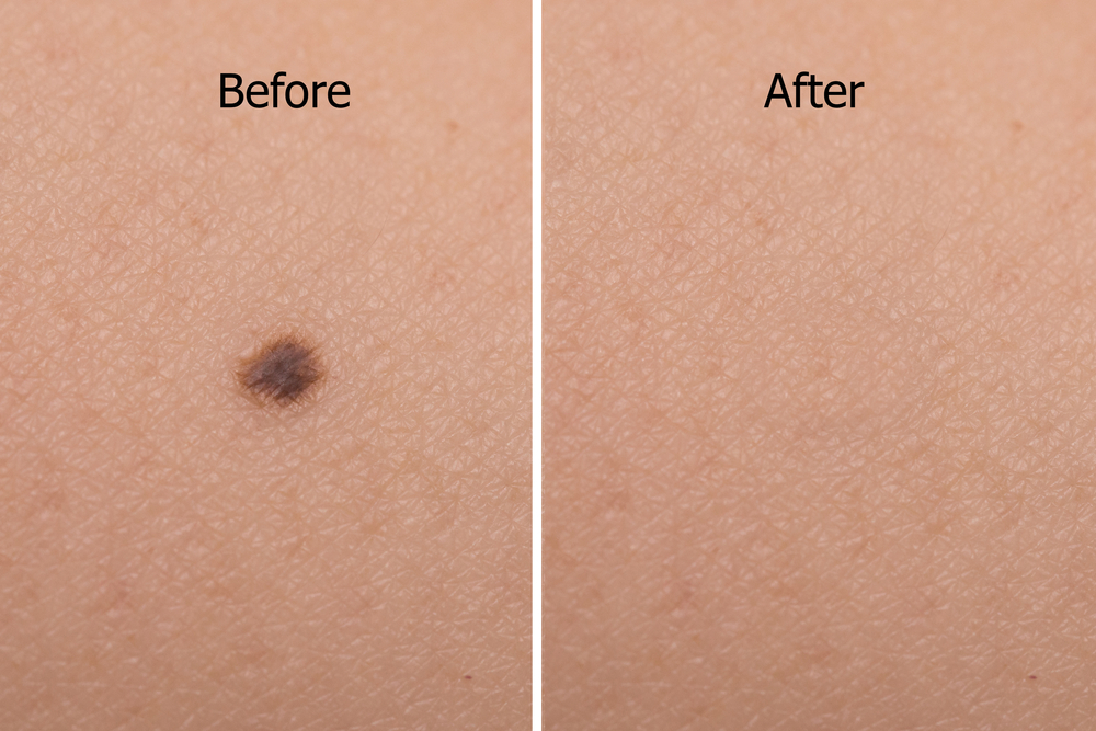 Best Skin Specialist Doctor in Surat