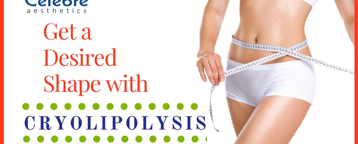 Cryolipolysis-Treatment