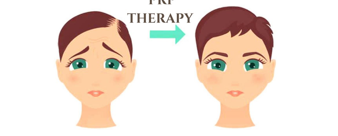 PRP-Therapy PRP-Therapy