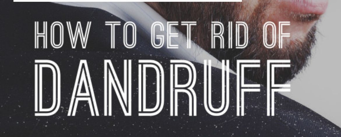 Dandruff-Causes-and-Treatment Dandruff-Causes-and-Treatment