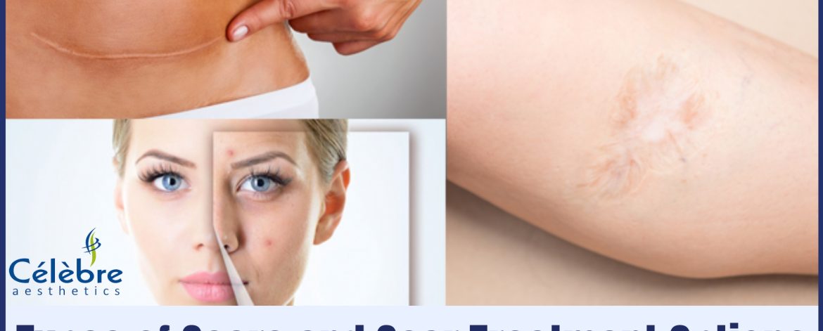 Scar-Treatment-Options-in-Surat Scar-Treatment-Options-in-Surat