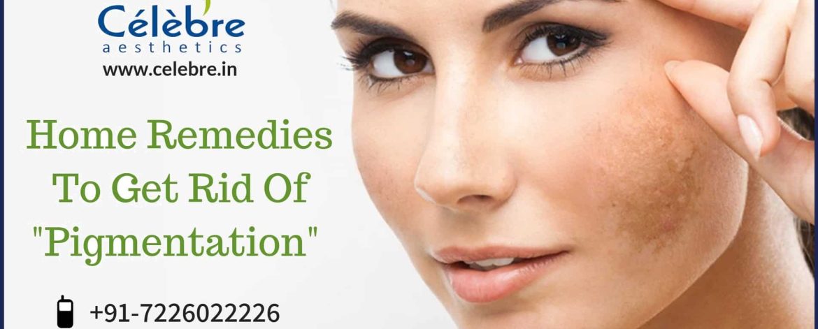 Home-remedies-to-get-rid-of-pigmentation Home-remedies-to-get-rid-of-pigmentation