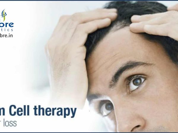 Stem-Cell-Therapy-for-Hair-Loss