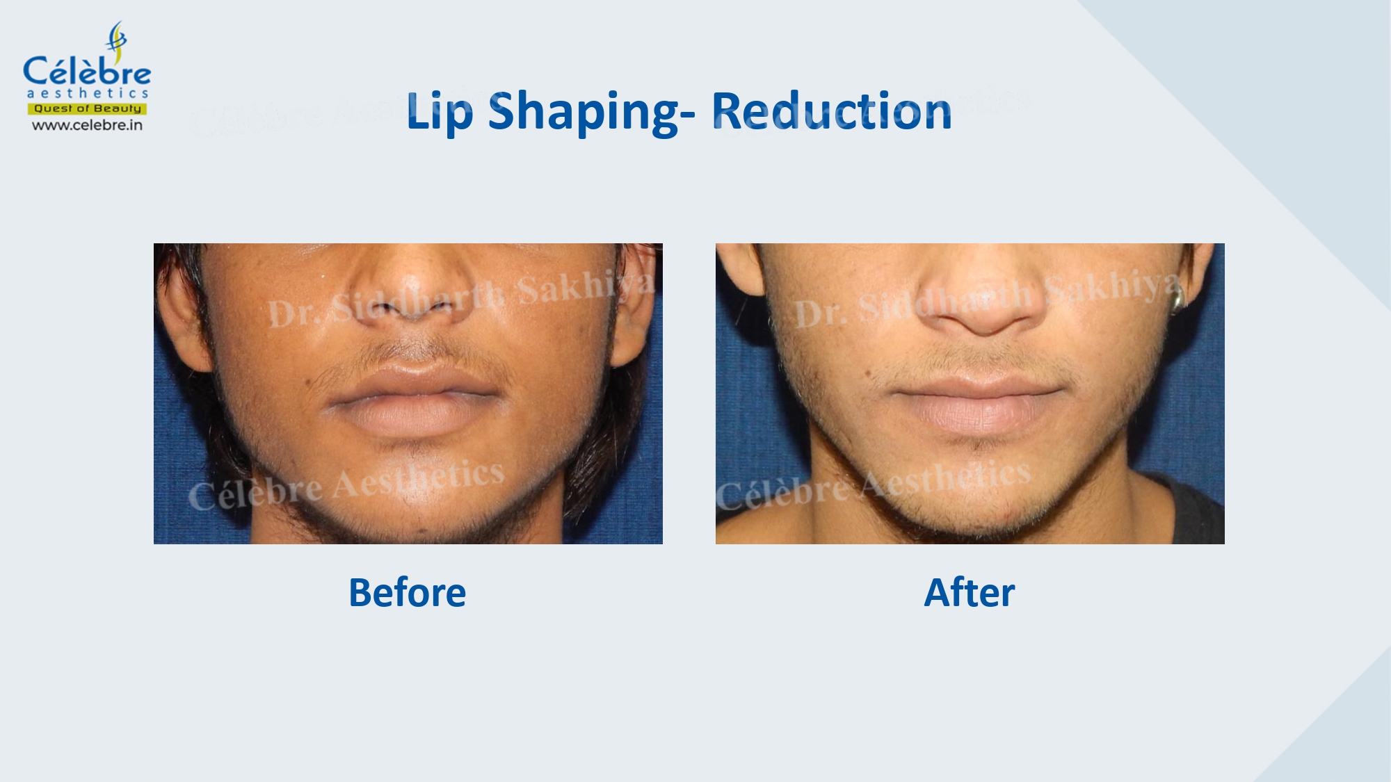 PPT (1)_page-0049