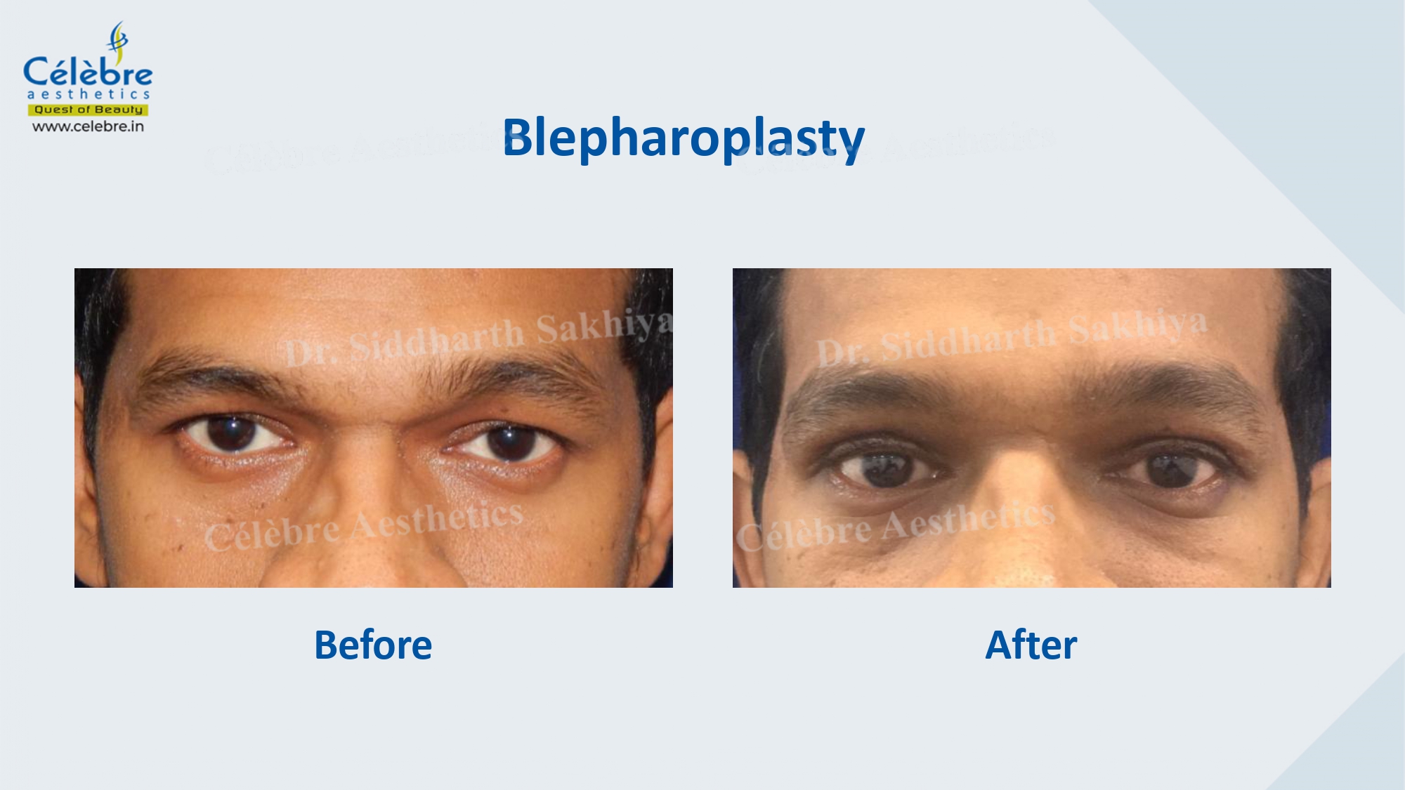 PPT (1)_page-0052