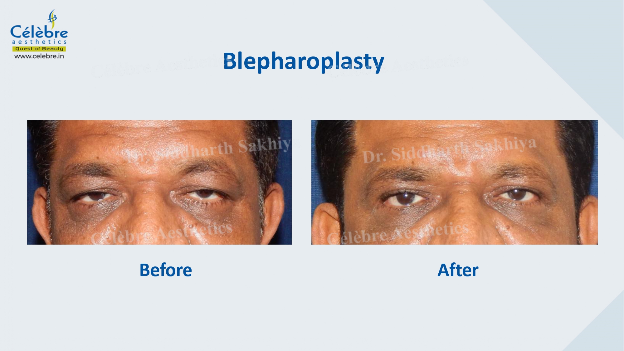 PPT (1)_page-0053